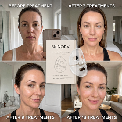 Glow Mask